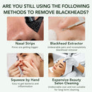 Purificador da pele purificador de vibração profunda limpador facial pá rosto purificador peeling cabeça preta removedor facial pele beleza cuidados ferramenta