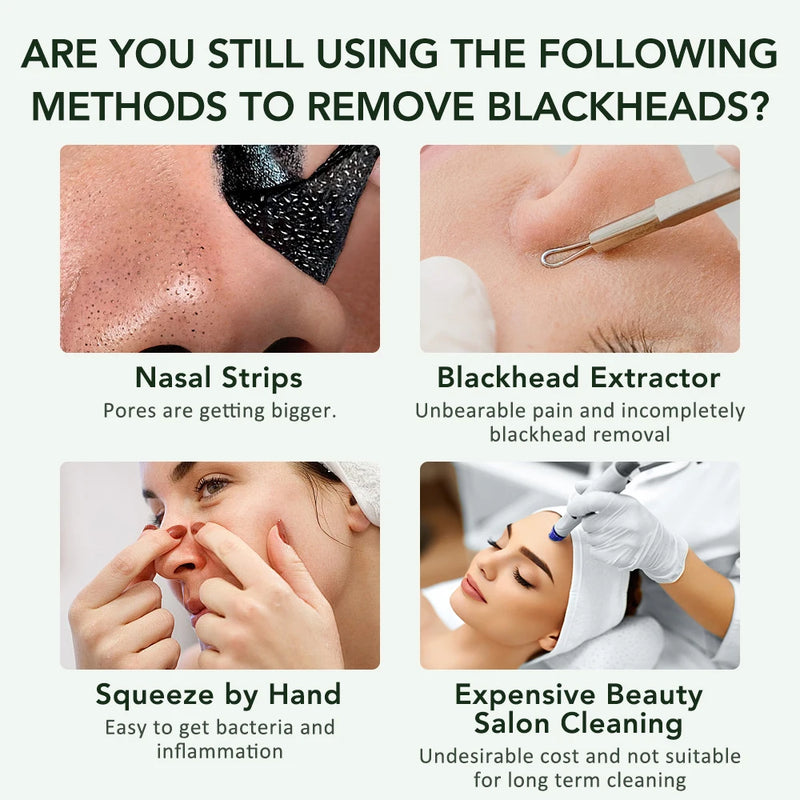 Purificador da pele purificador de vibração profunda limpador facial pá rosto purificador peeling cabeça preta removedor facial pele beleza cuidados ferramenta